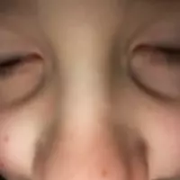 @Marcustheworm (nineja)