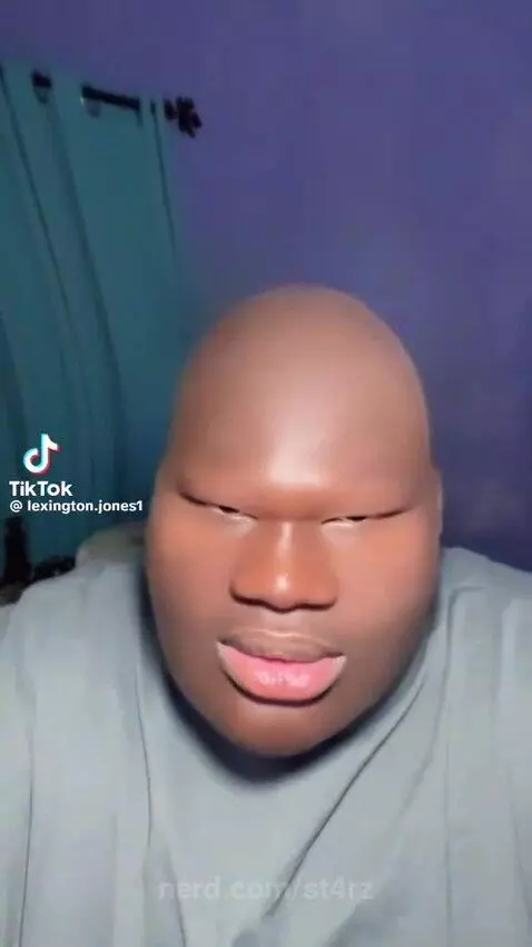 Autism lvl 10000000000 by st4rz