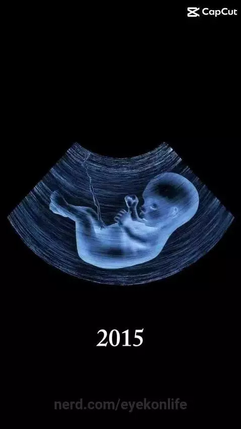 Babyyyy by eyekonlife