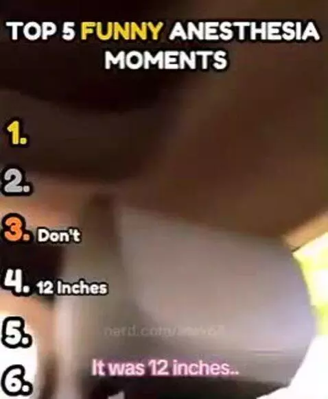funny anesthesia momets by alex67