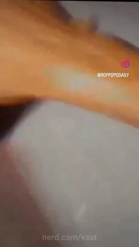 Roppo gng💩🙏 by vast