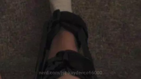 these are all my injuries from the past 5 years😭 by jst-kaydence66000