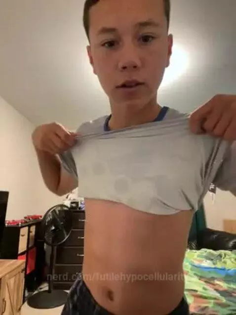 Video by futilehypocellularity
